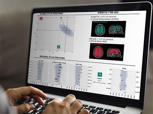 BrainTale : levée de fonds de 4,5M€ pour s’étendre à l’international