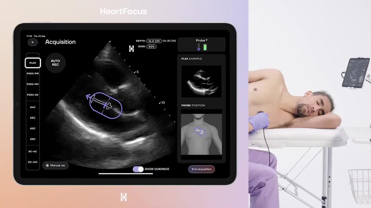 DESKi lève 6 M$ pour déployer son IA d’échocardiographie