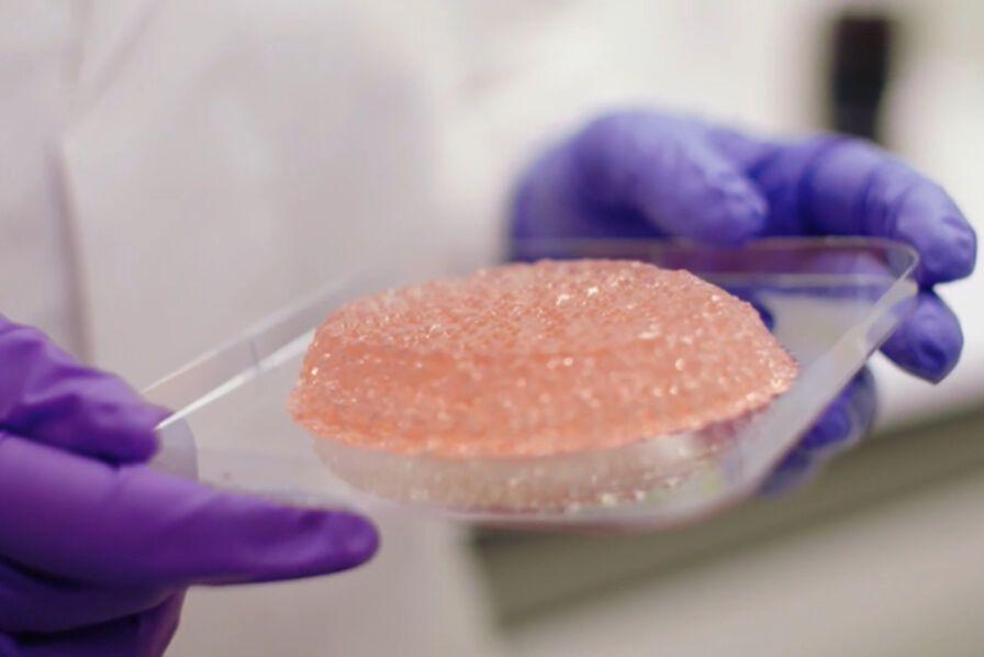 Healshape innove pour la reconstruction mammaire